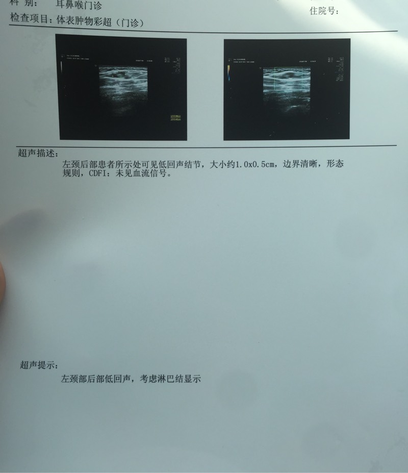 120939sqe1ae1lhusqap9a.jpg