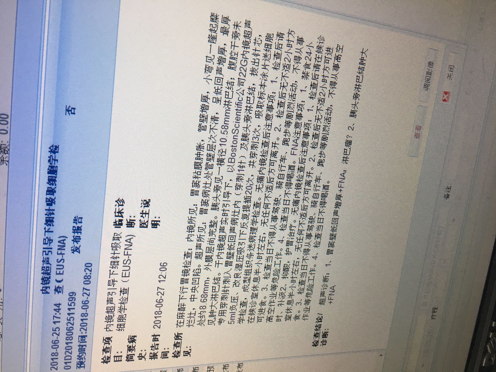 211755qauawz8rw8bbu888.JPG