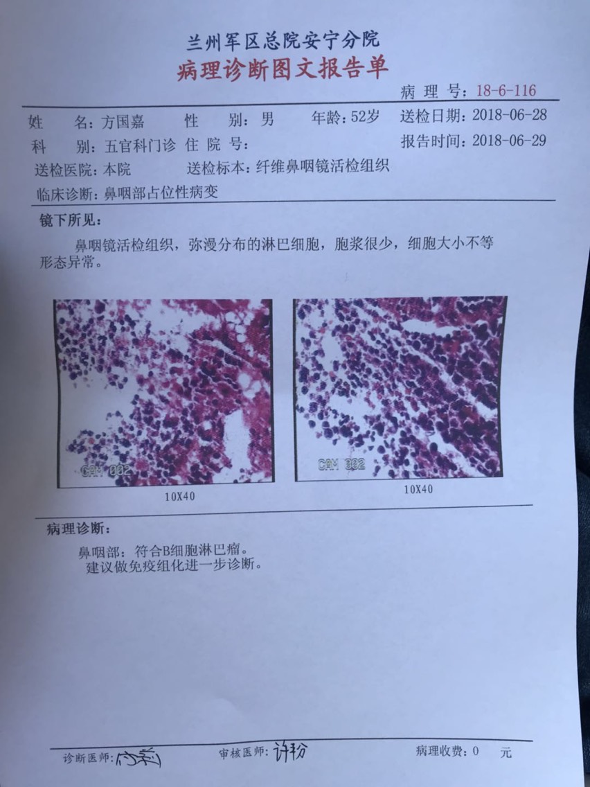 095628uifu2i5zetzlele1.jpg