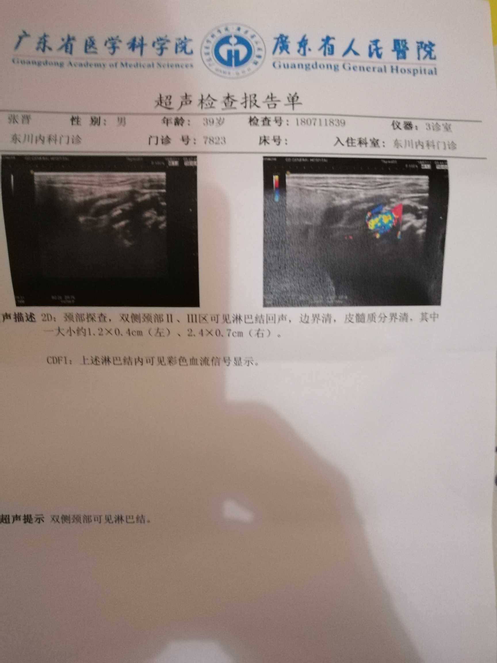 112621ipnp5onhi4s84cy3.jpg