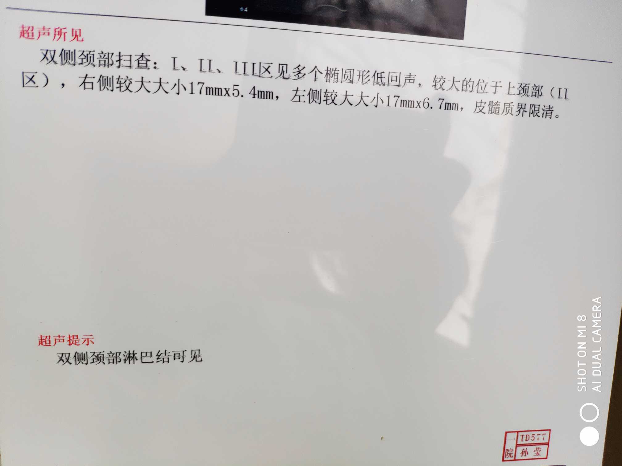 132020n796eo95553jf1ey.jpg