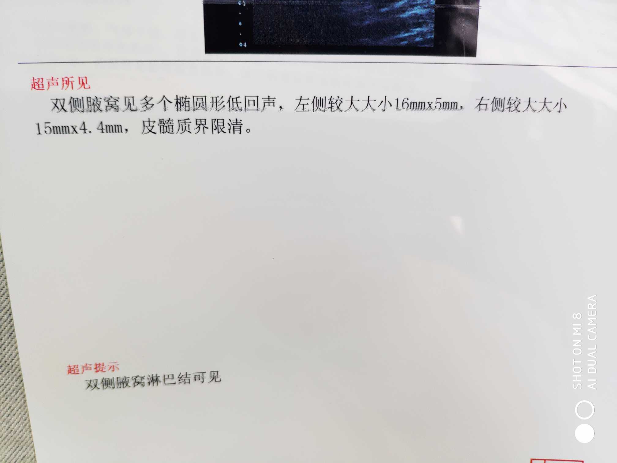 132021cmuhi5nf5h900jgy.jpg