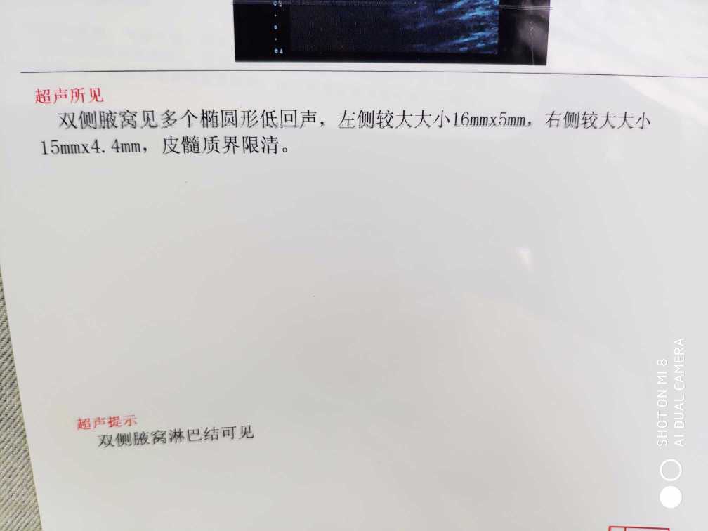 134009h983l08yll7dg98g.jpg