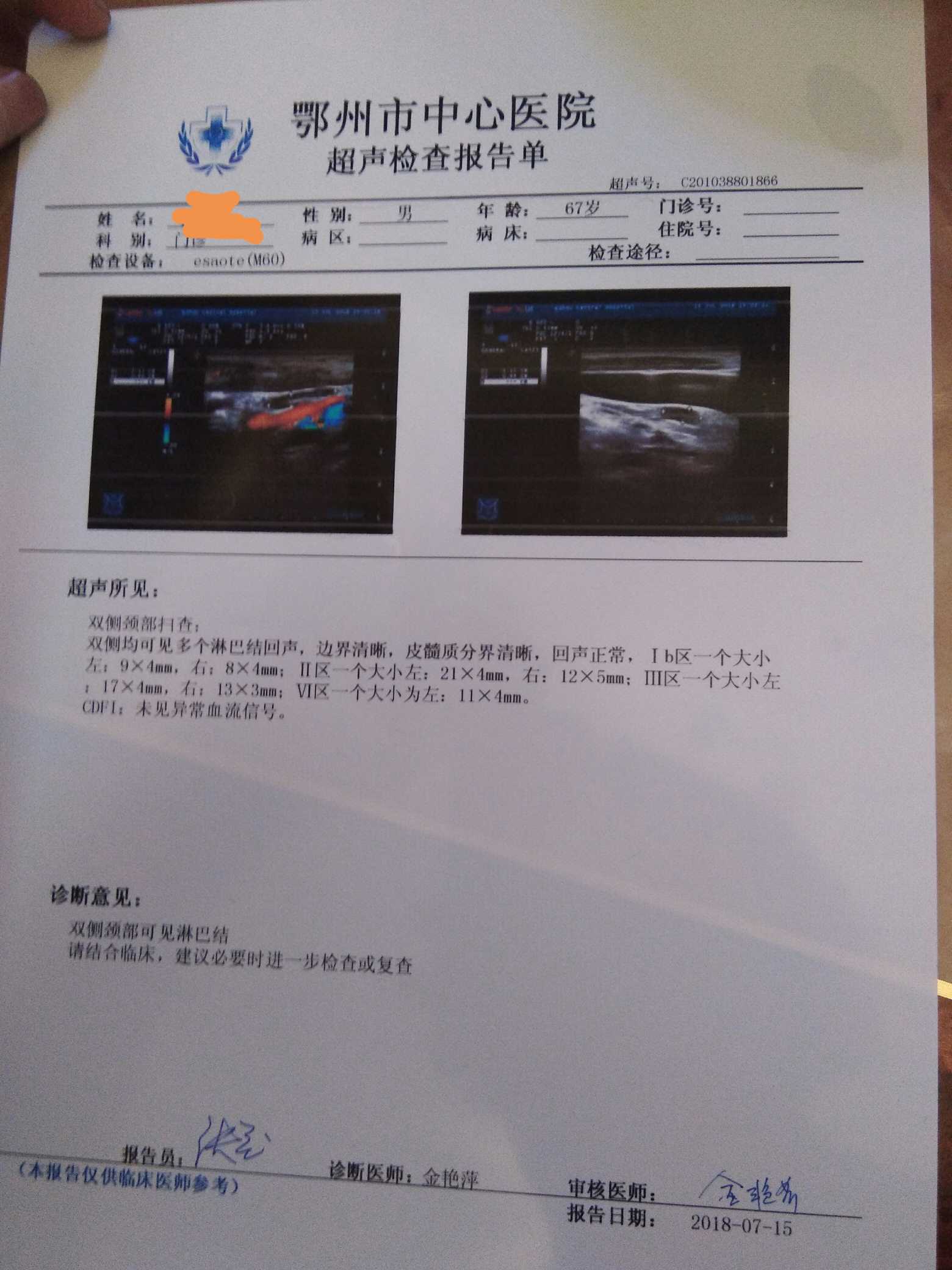 150416clbkgu350sb53lhu.jpg