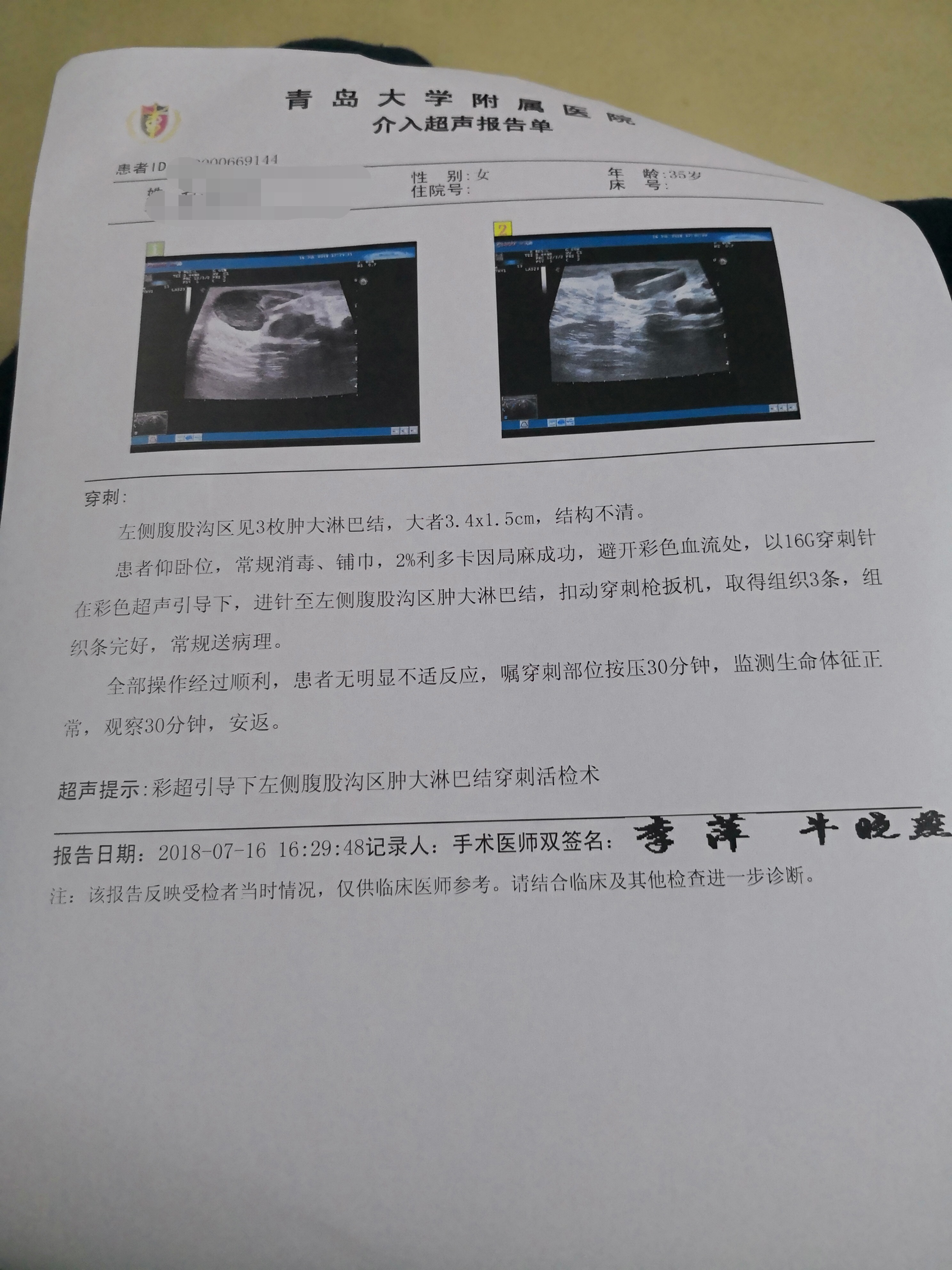 211712ccpczhrv1qz177rx.jpg