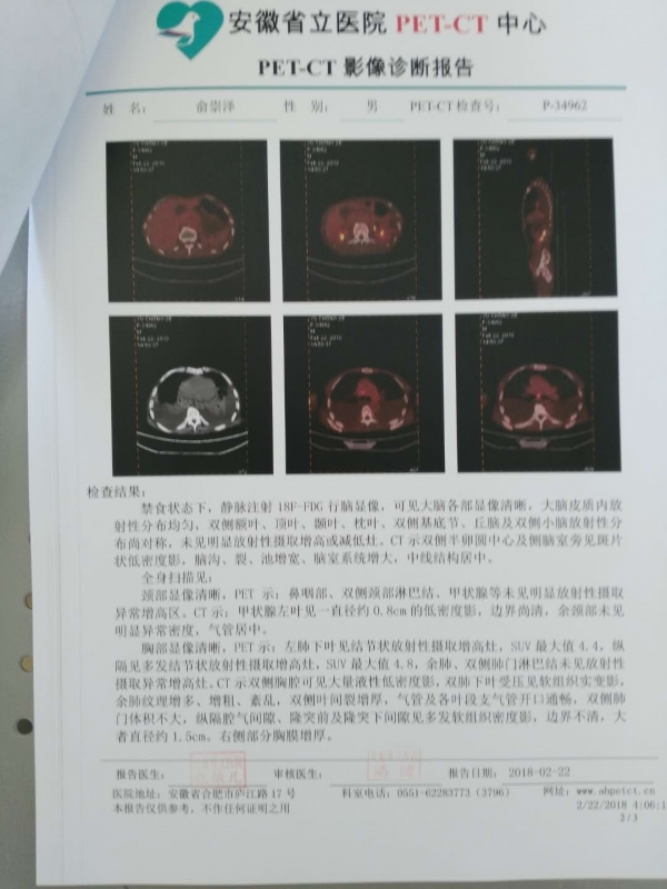 PET-CT影像诊断报告