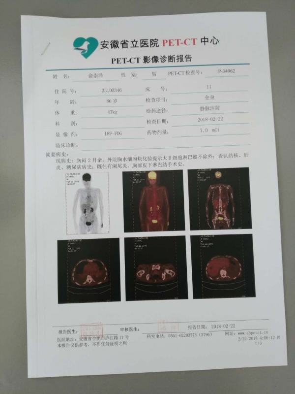 PET-CT影像诊断报告