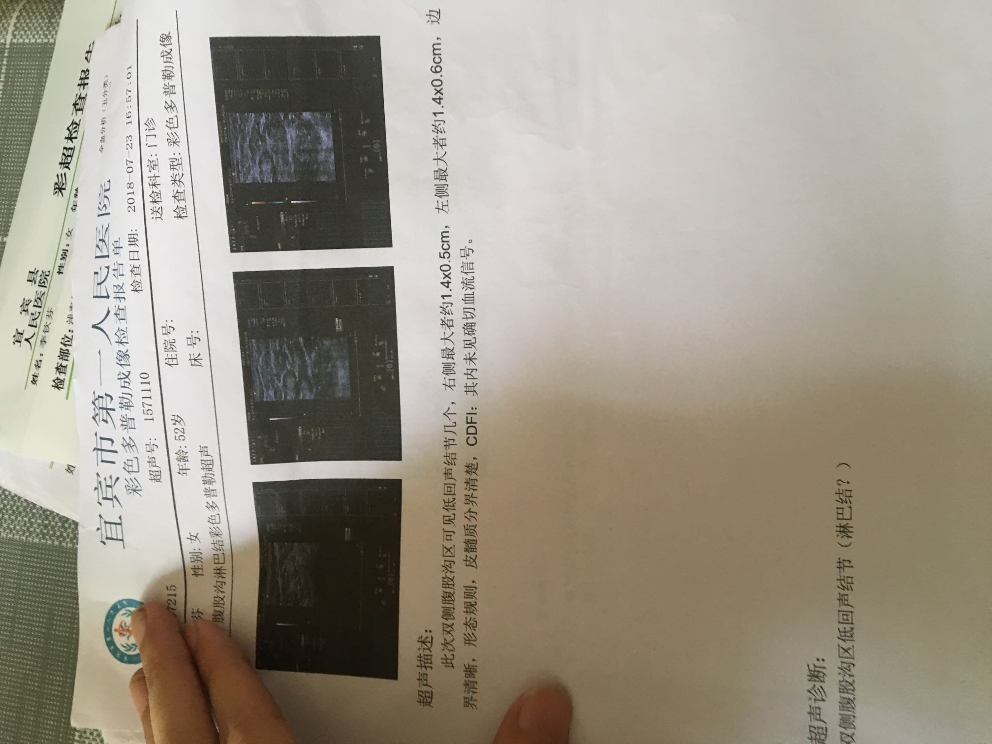 235506jp919v9v9l8ed79t.jpeg