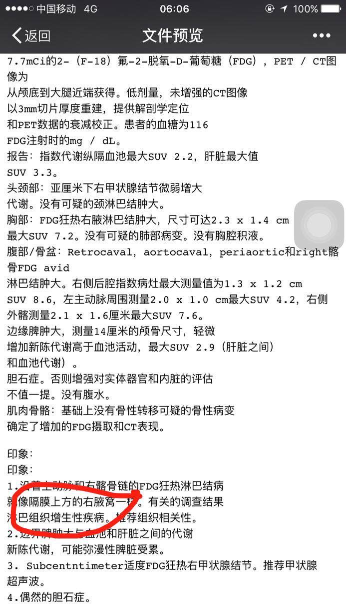 145350cengnnbehrh8nb1n.jpg