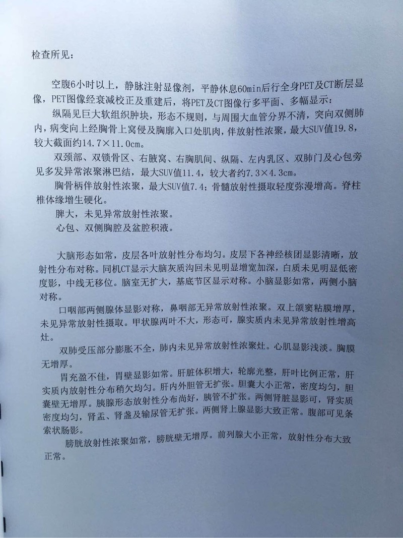 161915o8osm6tkkx5xykii.jpg