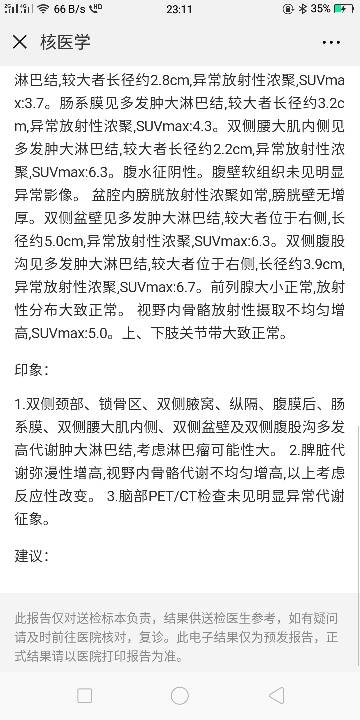 163310kzmfvf1ctcm82200.png
