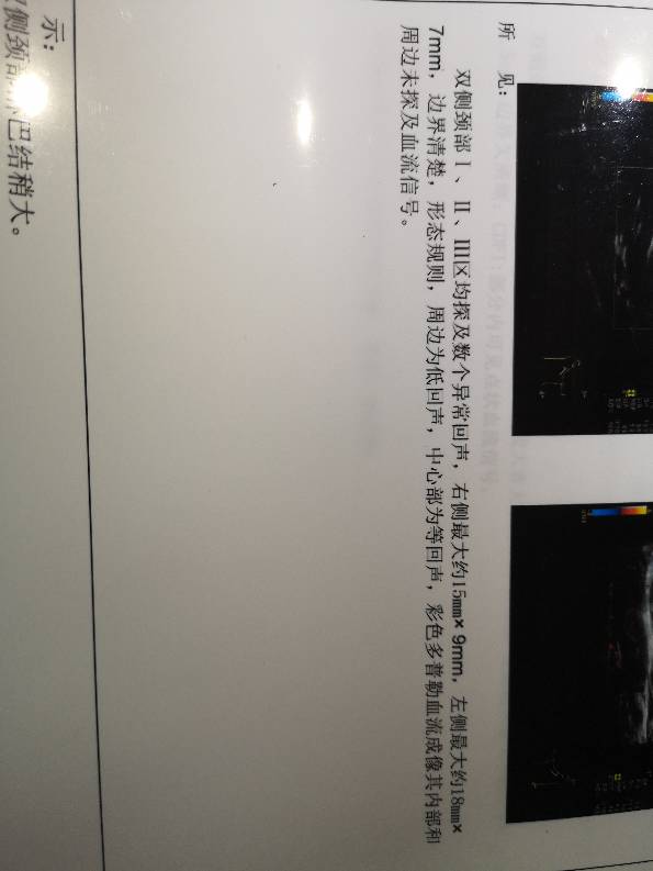 005133wk361ezc2mmq6k8k.jpg