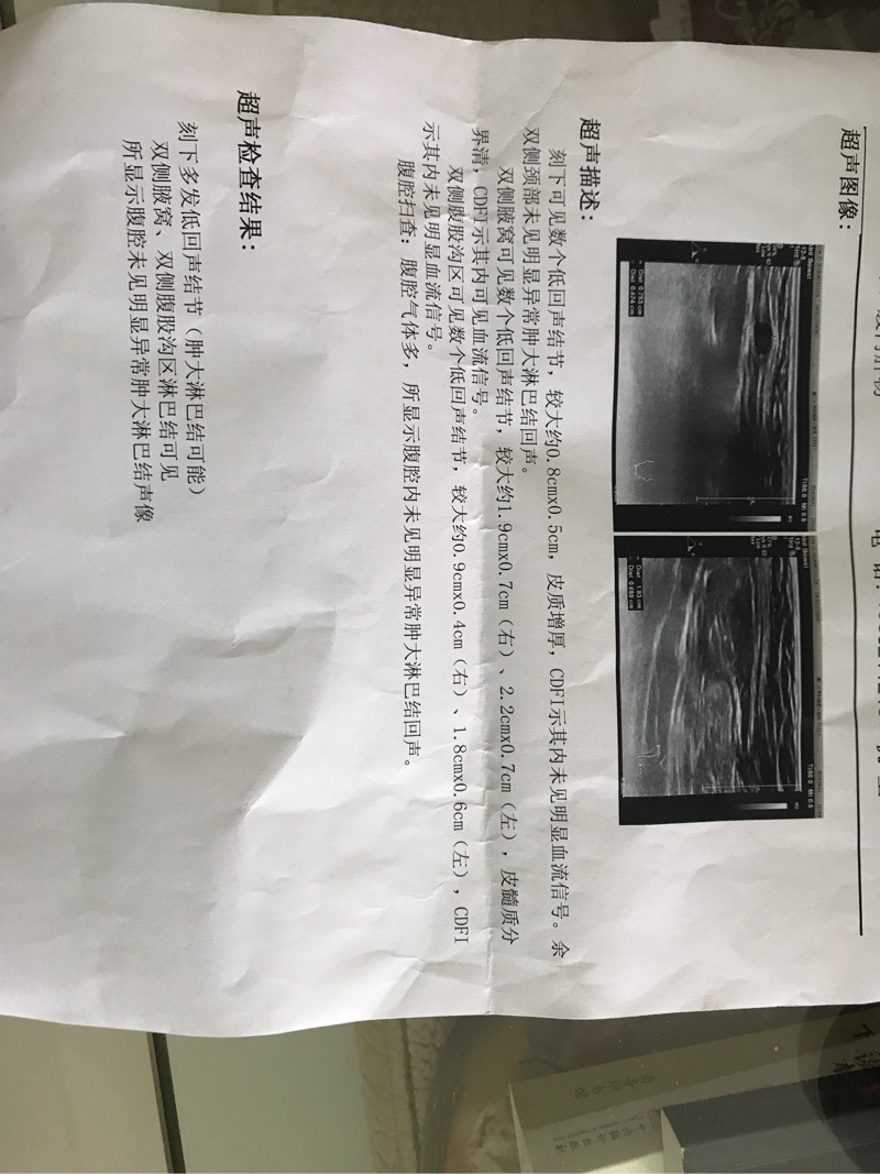 133325ra6b7am77c47hmb4.jpg