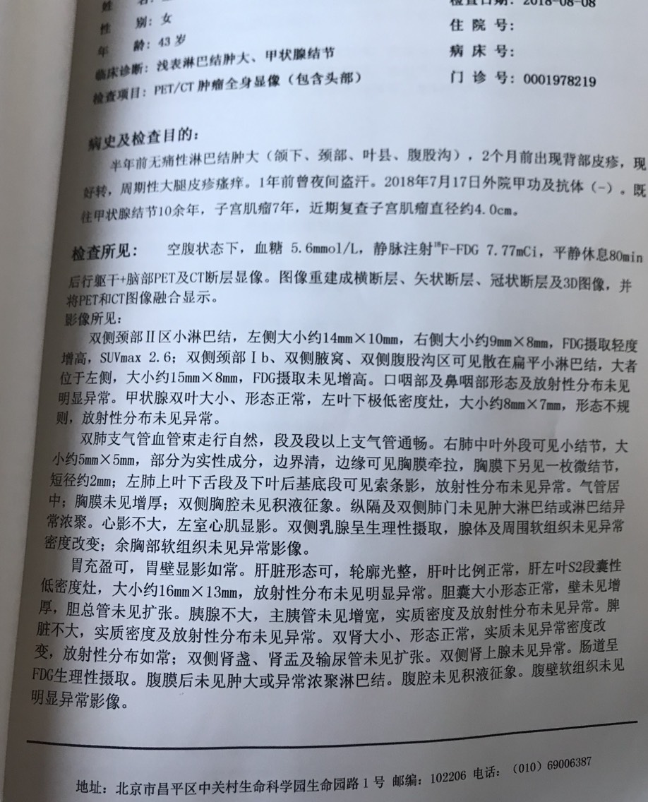 151300wk6sn9nihi269eup.jpg