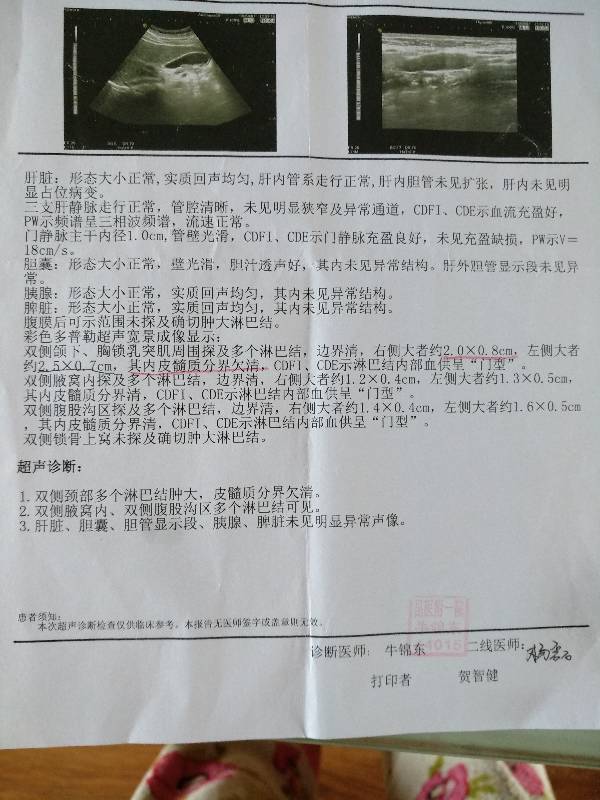 205604iig6g66jj1g2212e.jpg