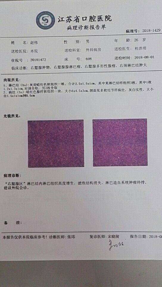 123044jsqvtjilc3vdn7qr.jpg