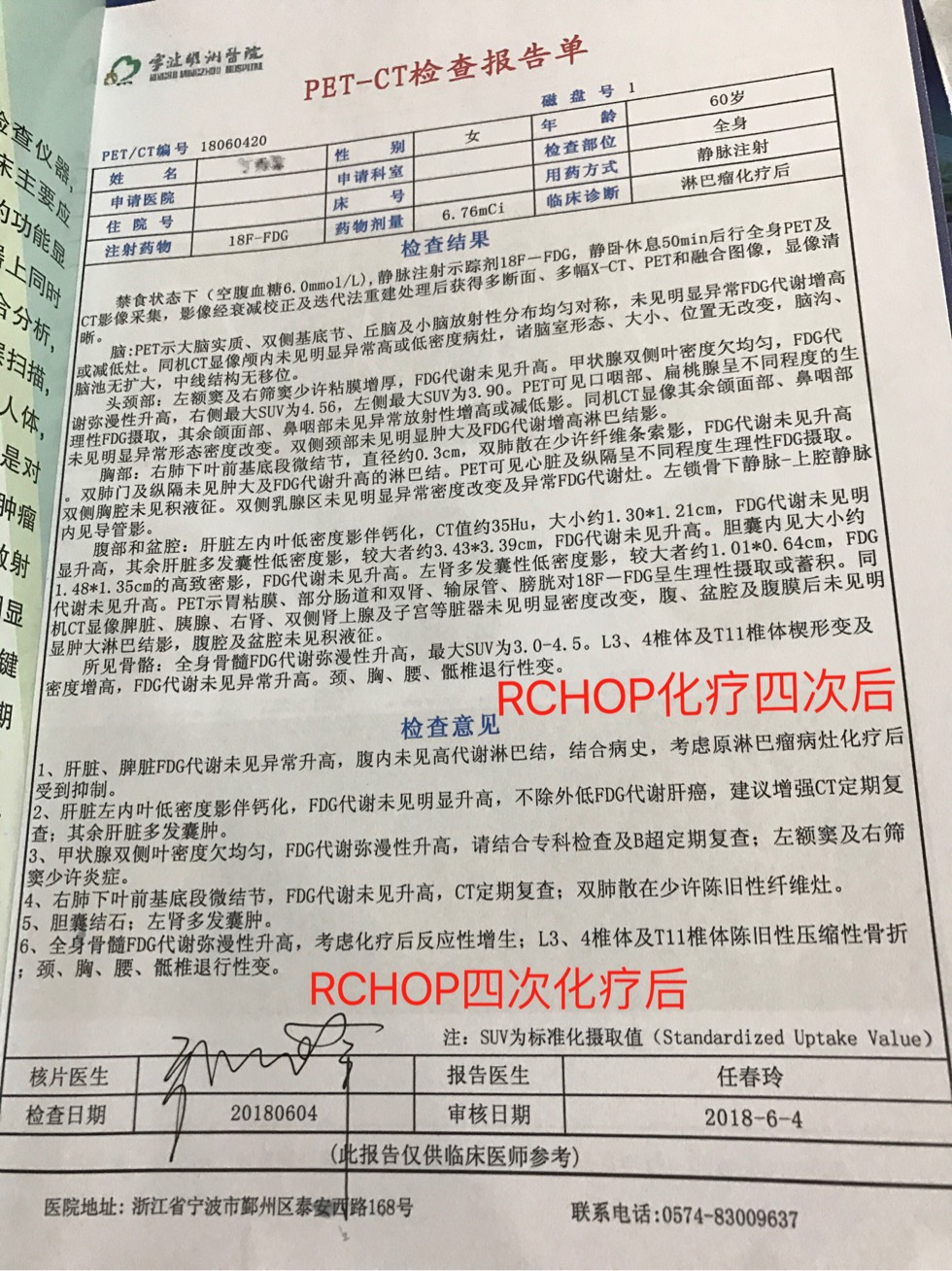 164131f02m47hq45og0ygy.jpg