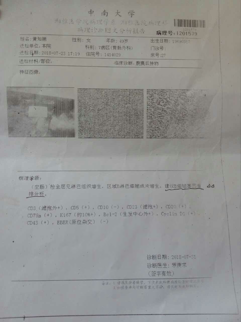 135318xbcmtj7qtgjc9pwc.jpg