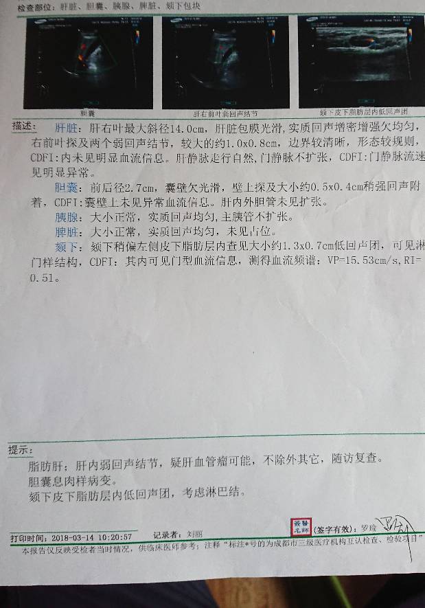 093841qzh13cffb4f4393u.JPG