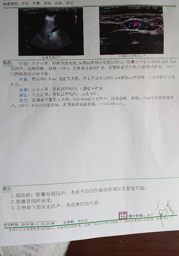 093842op5v3z2m5opv9p2o.JPG