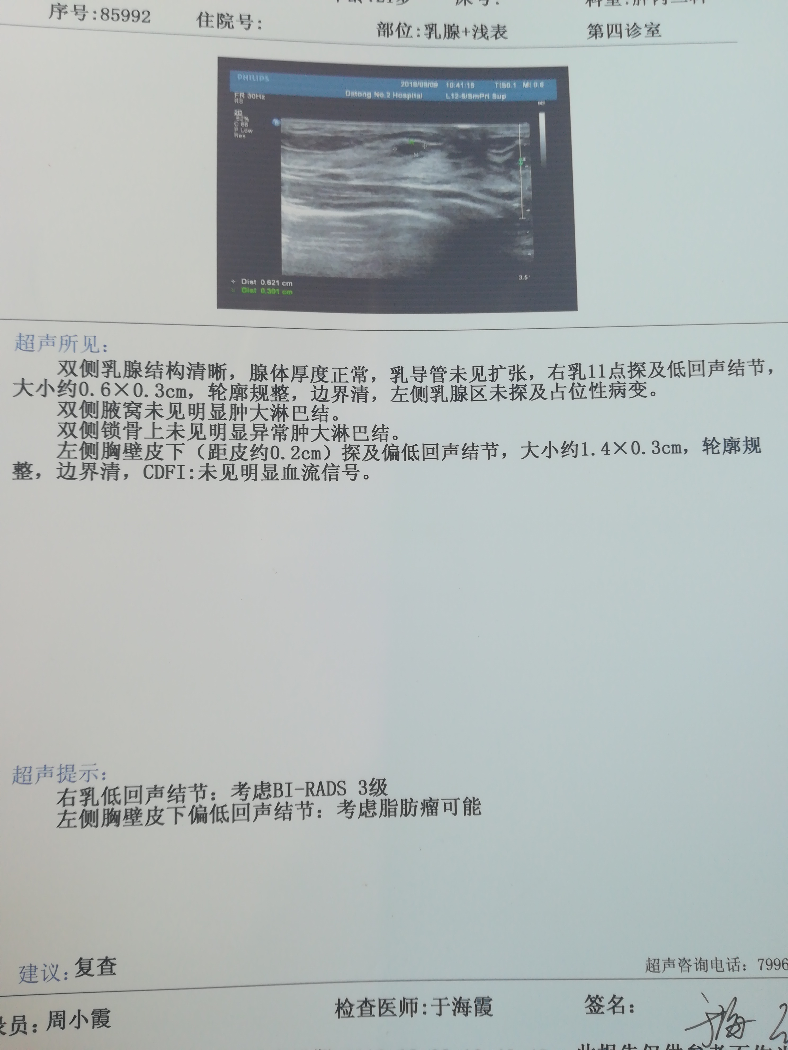 162702ece1pkncpxhqxode.jpg