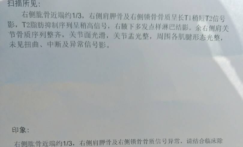 155325vp18cgnmc1qcdqqp.jpg