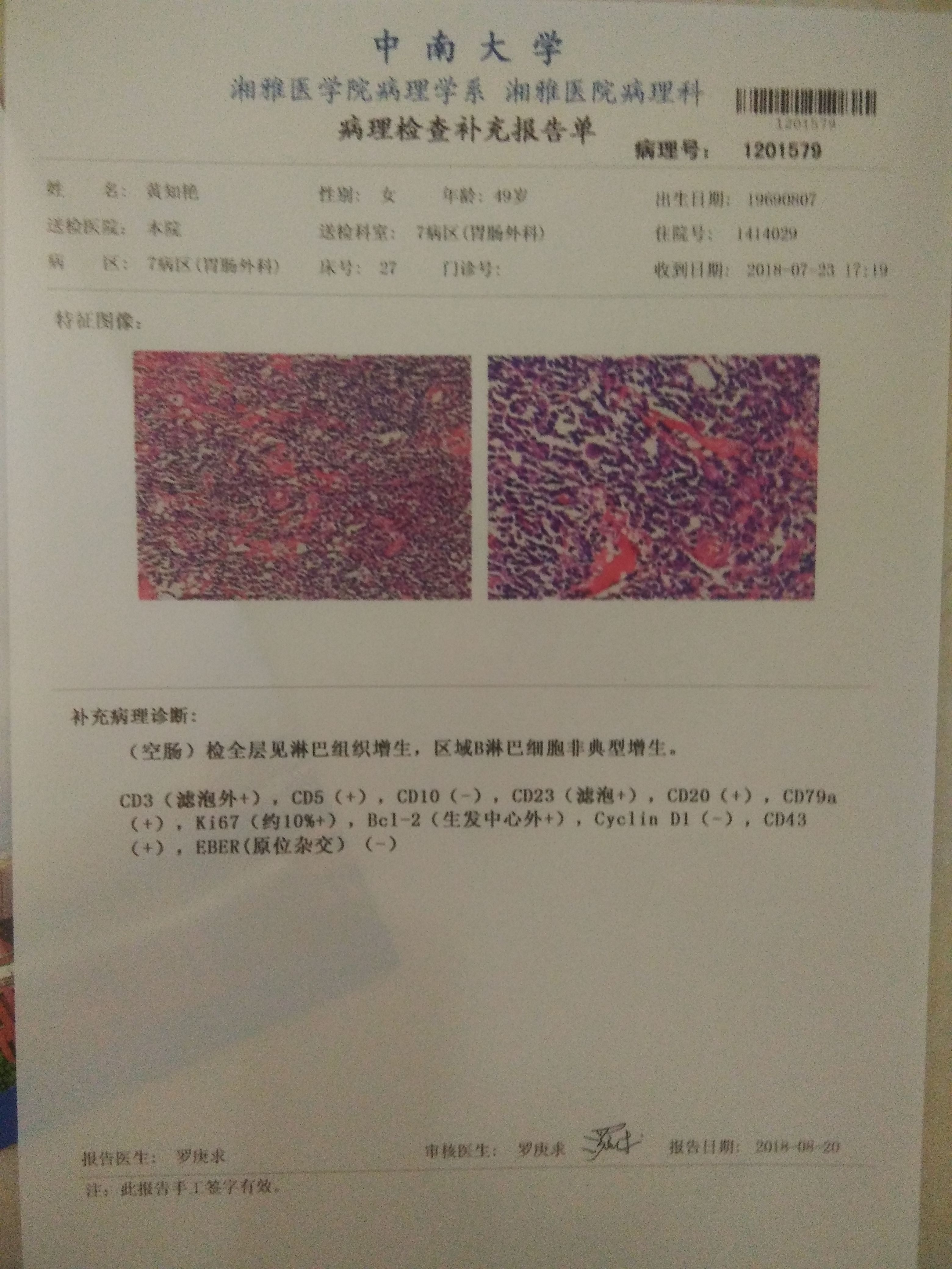 075946frmbmb0vuzudu5zm.jpg