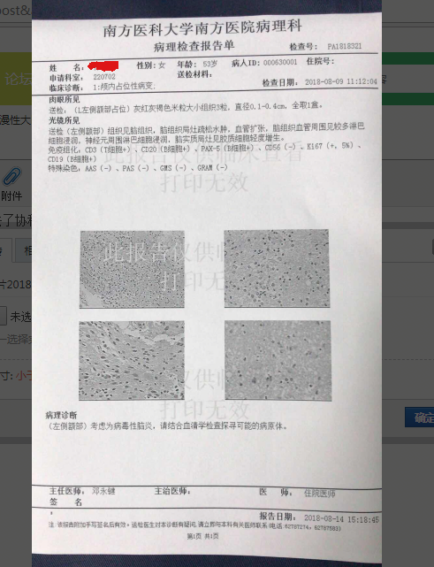豆芽图片20180830091325.png
