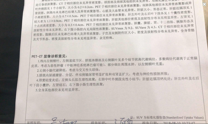豆芽图片20180830091209.png
