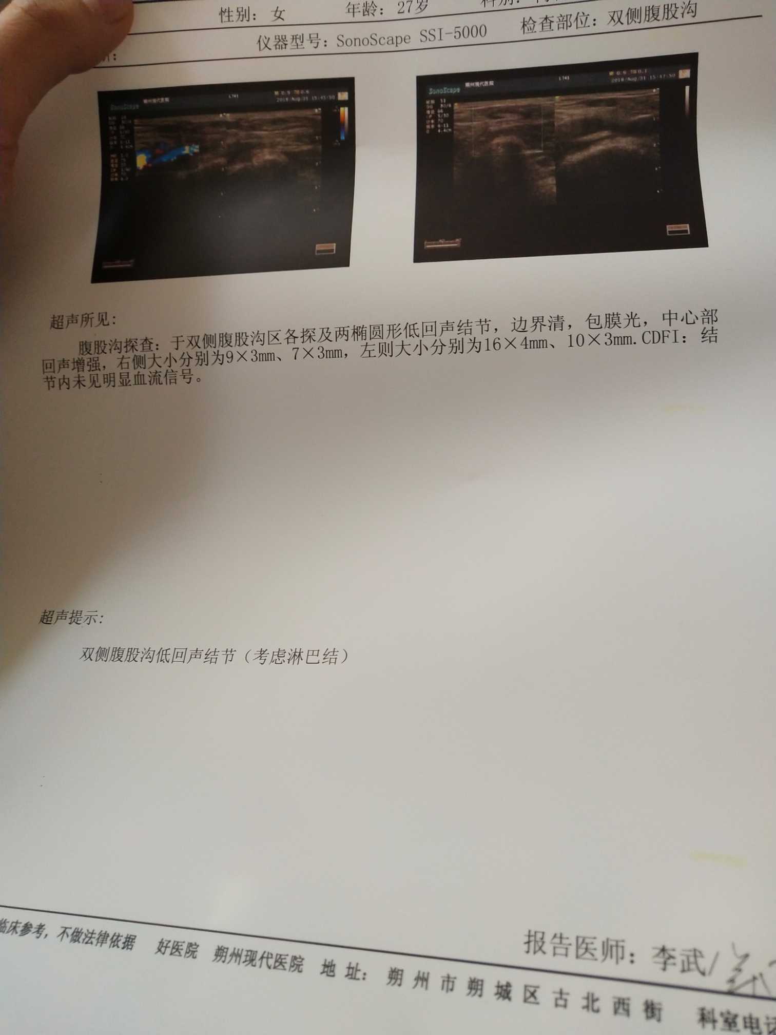 124802ler29mj2myqfmfru.jpg