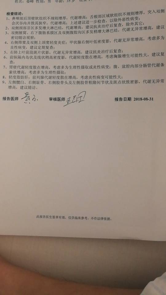 150523hgh4zs48zv9srser.jpg