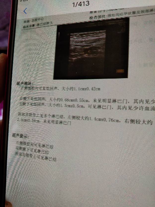 123106sm7ecz9duz0pgppy.jpg