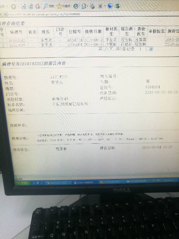 133007ghgwt6egr617kexz.jpg