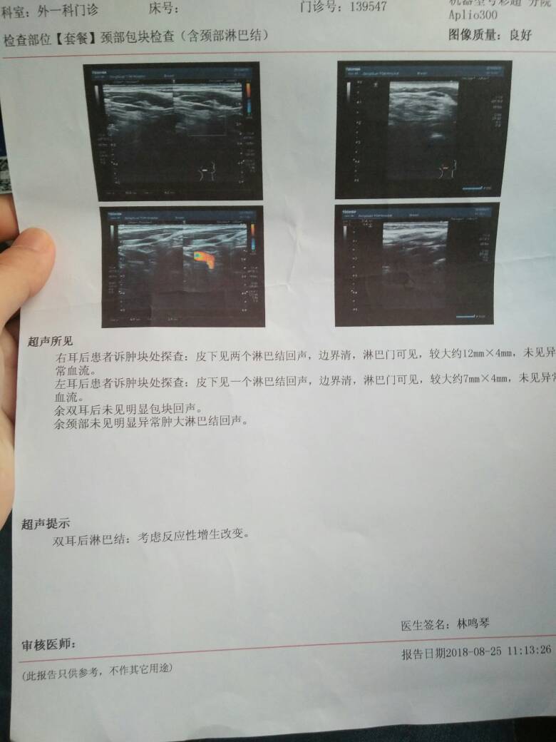170405qbabbb38i9ibfiic.jpg