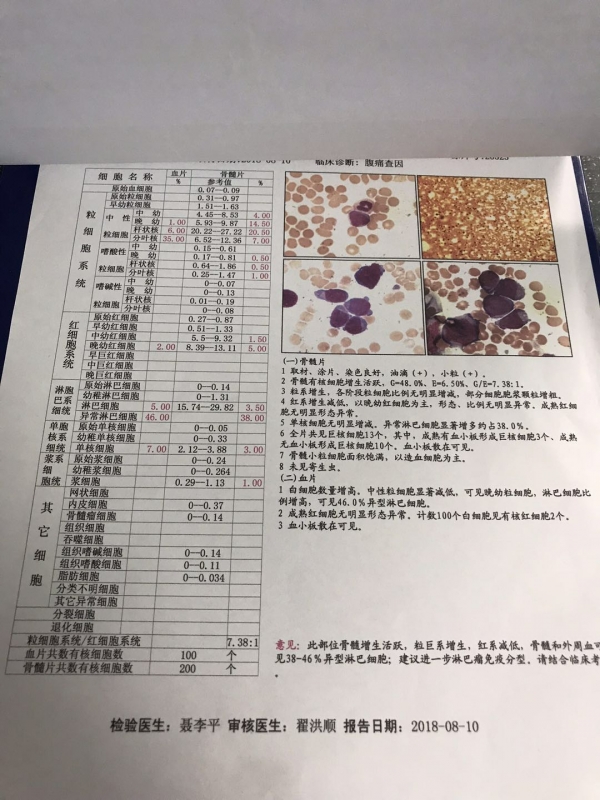 骨穿