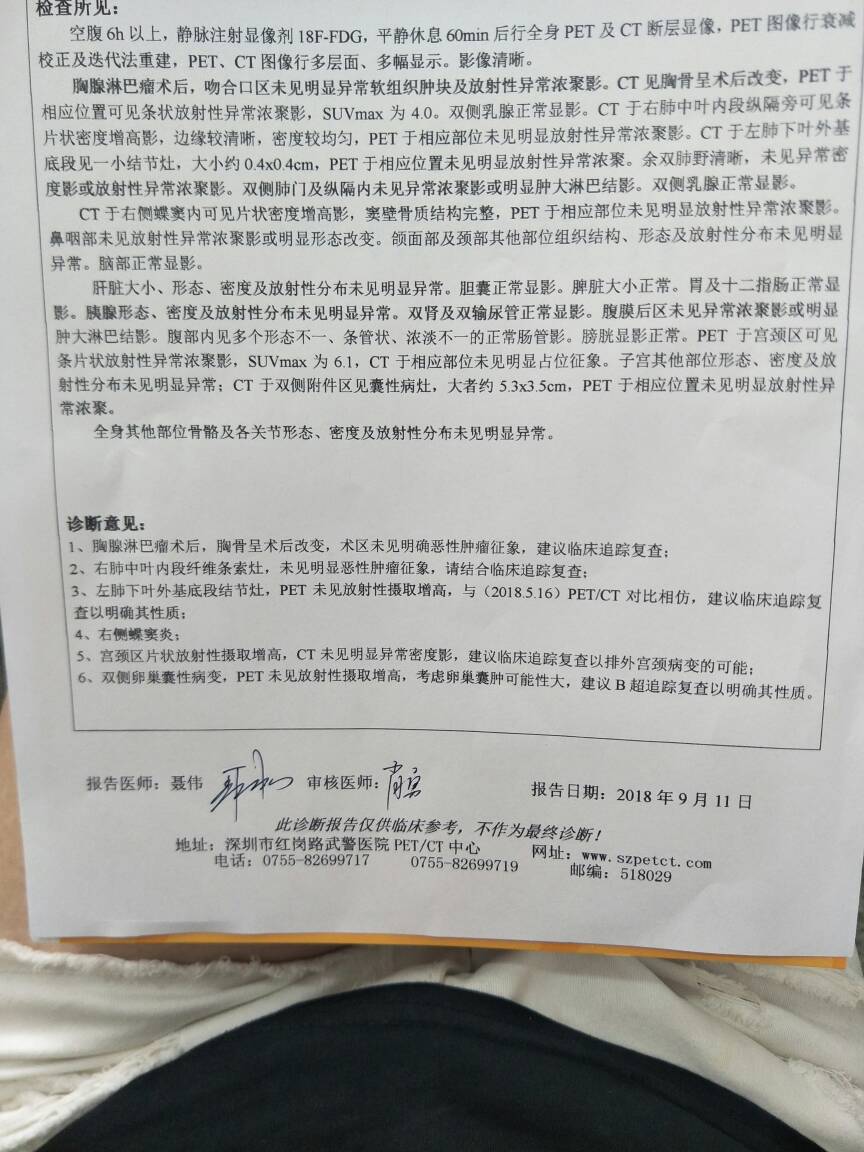 121350y8ywzb2144nuw814.jpg