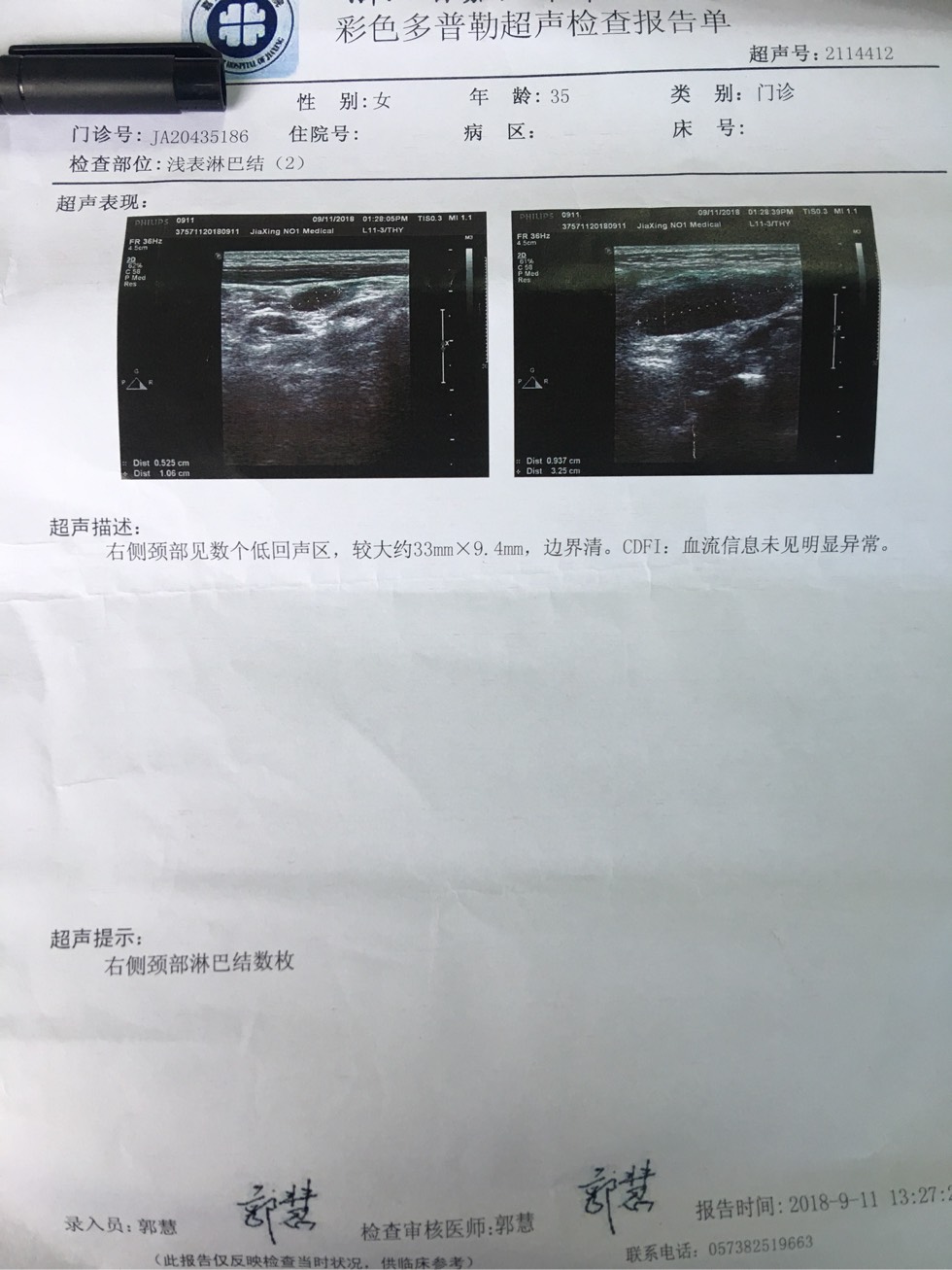 171600i2sasqs74g7z17lg.jpg