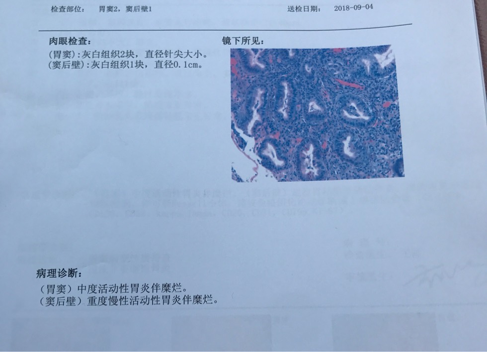 190208cbp5evpxbwo892c6.jpg