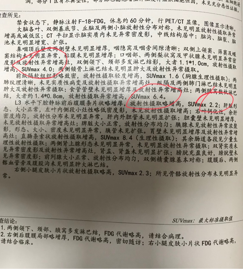 181752zerotrv3vniqnjro.jpg