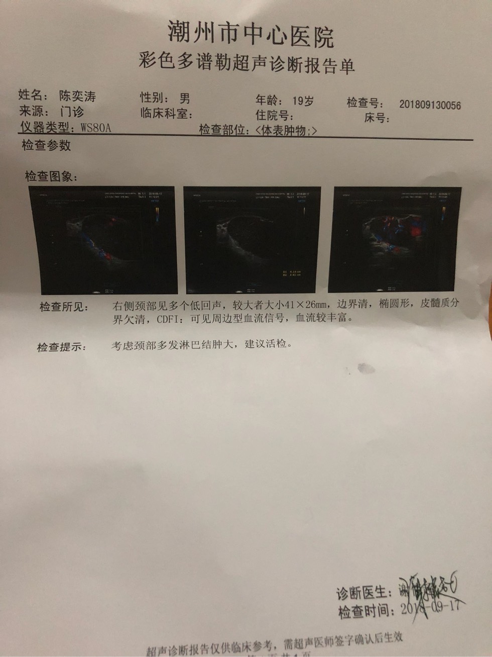 183301pa6sppp32s2pbs3g.jpg