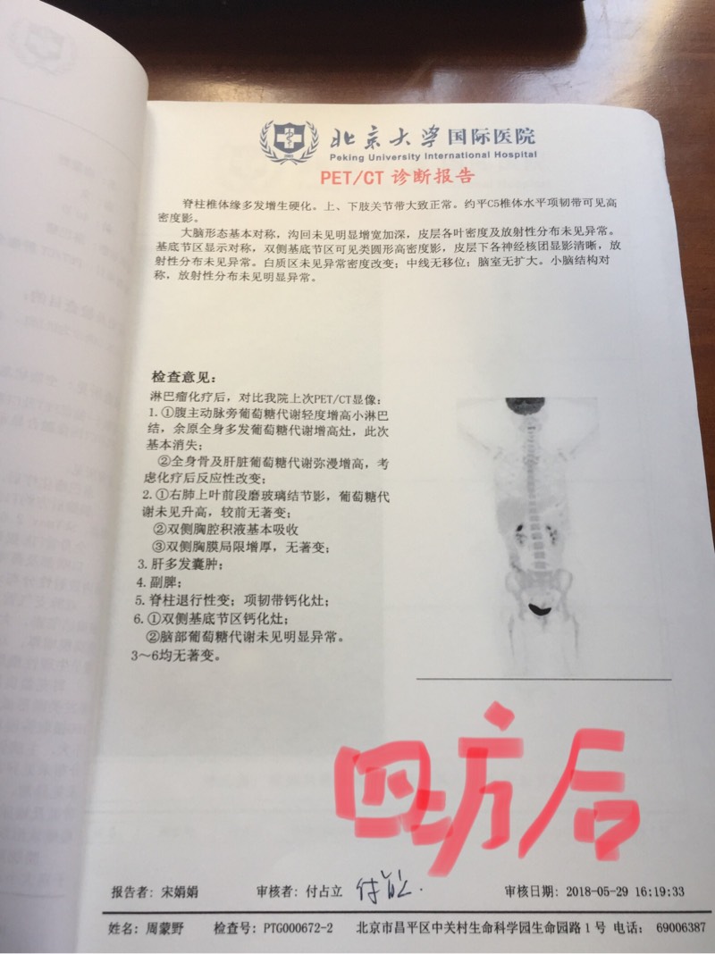 152045a554hutqznhck9ln.jpg