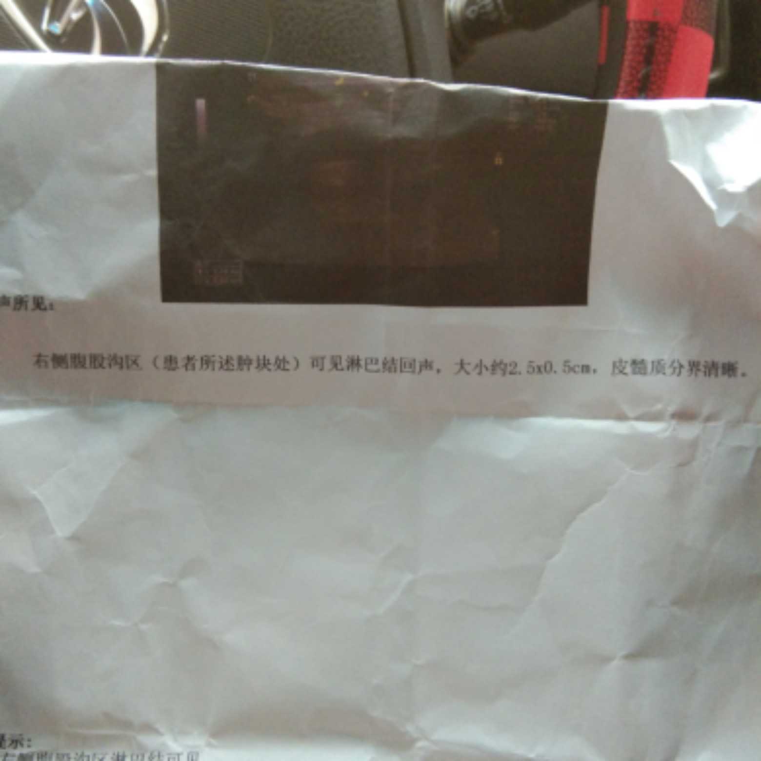 155346rrrqcitgrqbrzcrt.jpg