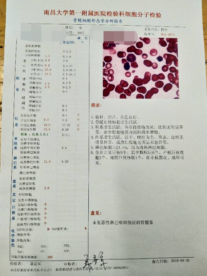 123537qrdor5w4m55ofrto.JPG