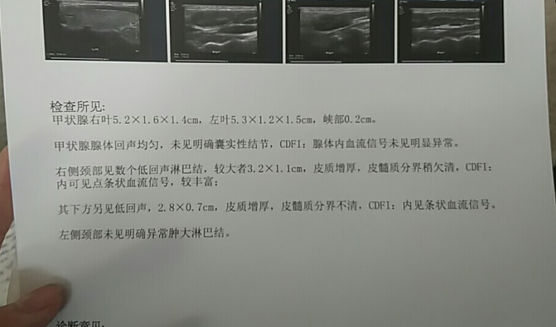 彩超
