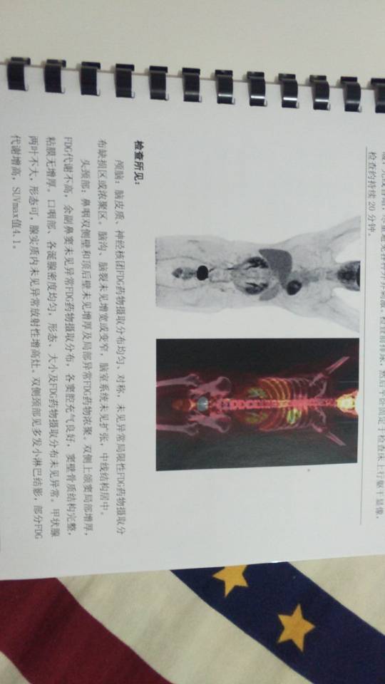 003726q5nuouklp6syoo80.jpg