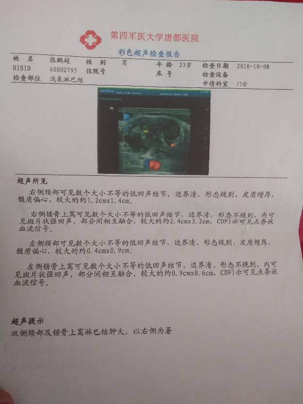 092931fua6bmfggngn66op.jpg