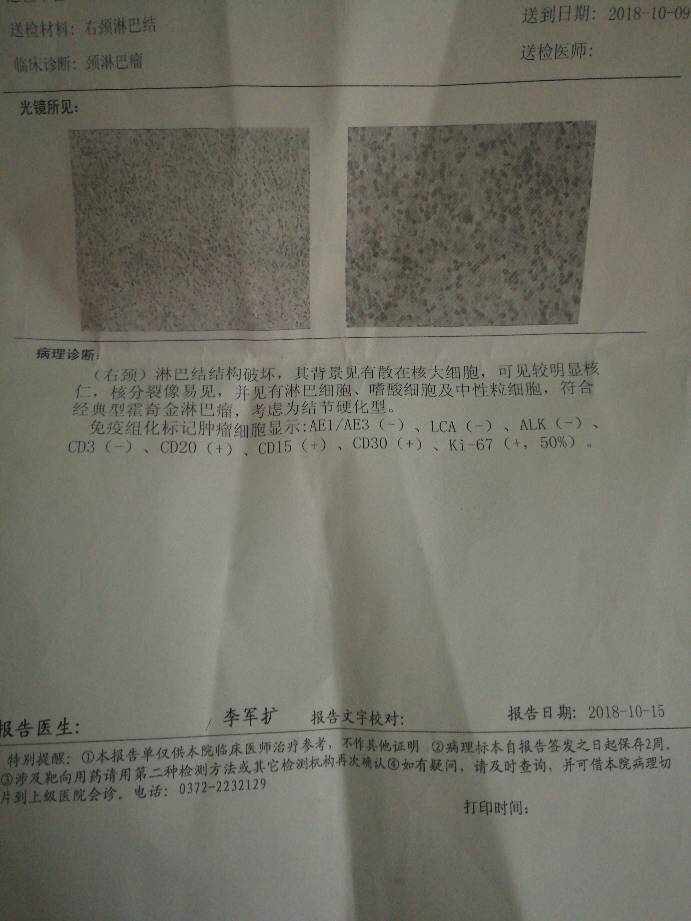 171240olcgaqftnd5jllcc.jpg