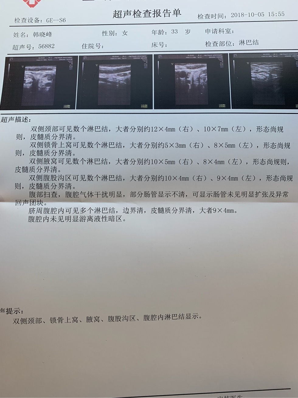 014912xwbc6dy9ccd9d1mv.jpg