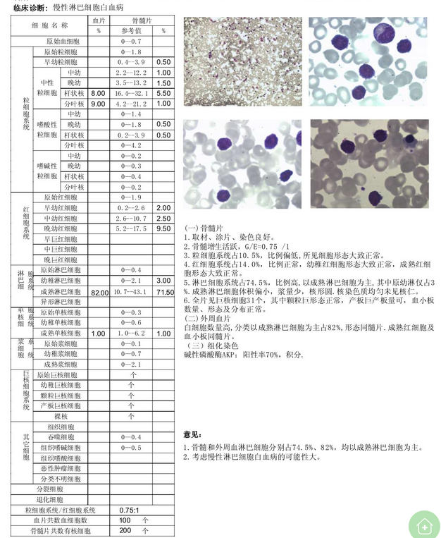 骨髓报告.png