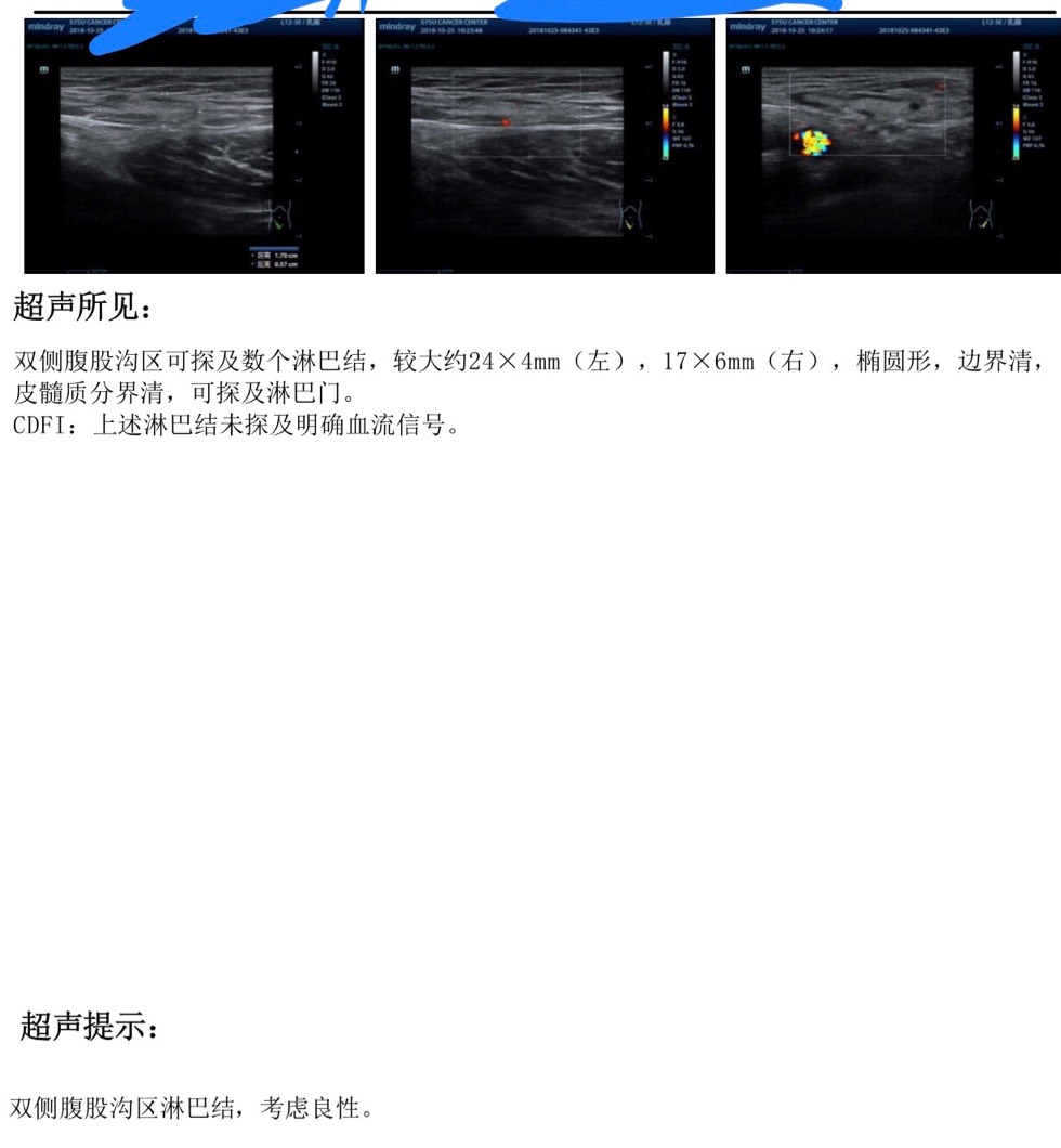 125524cv8qbx7vb0rvz3x0.jpg